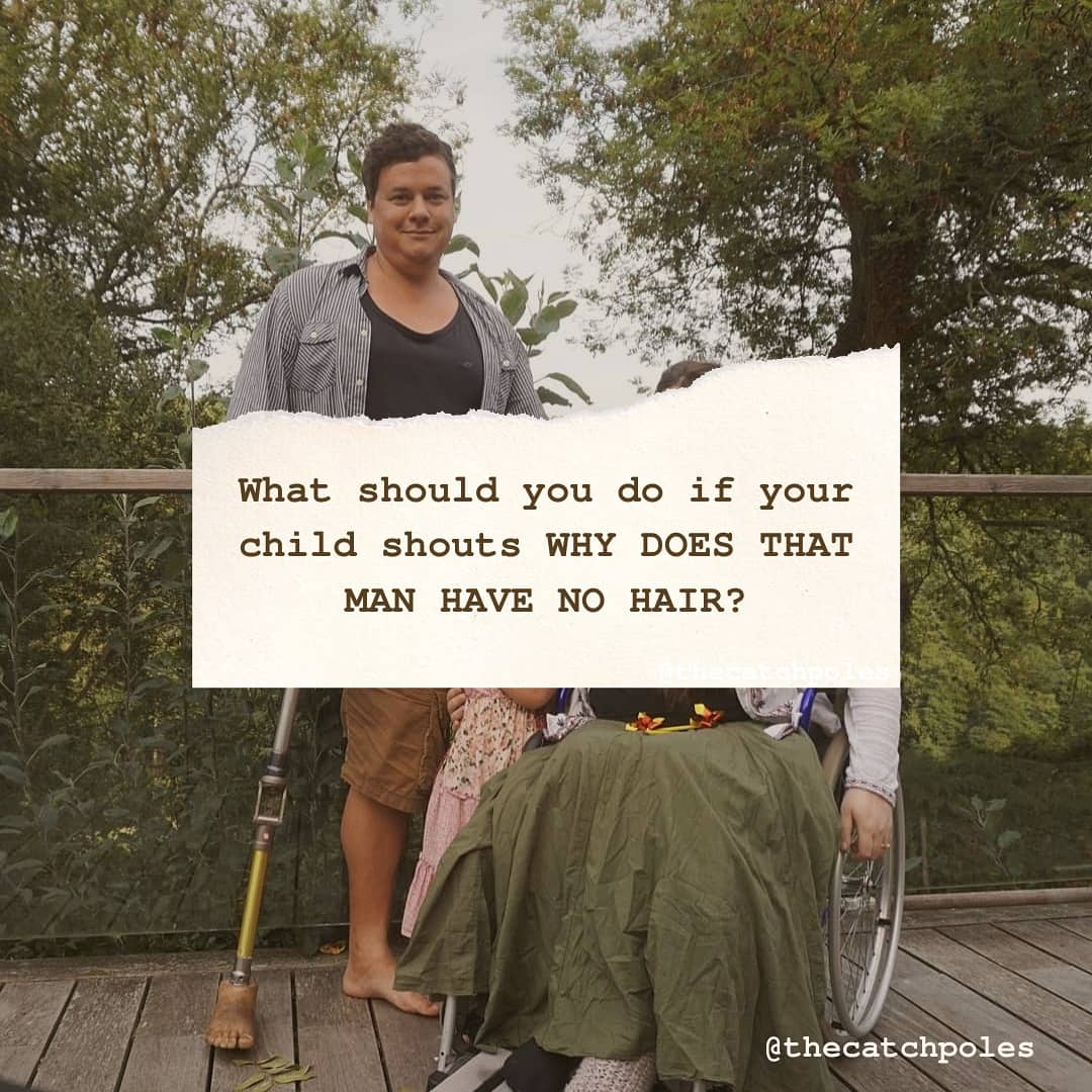 What should you do if your child shouts WHY DOES THAT MAN HAVE NO HAIR?